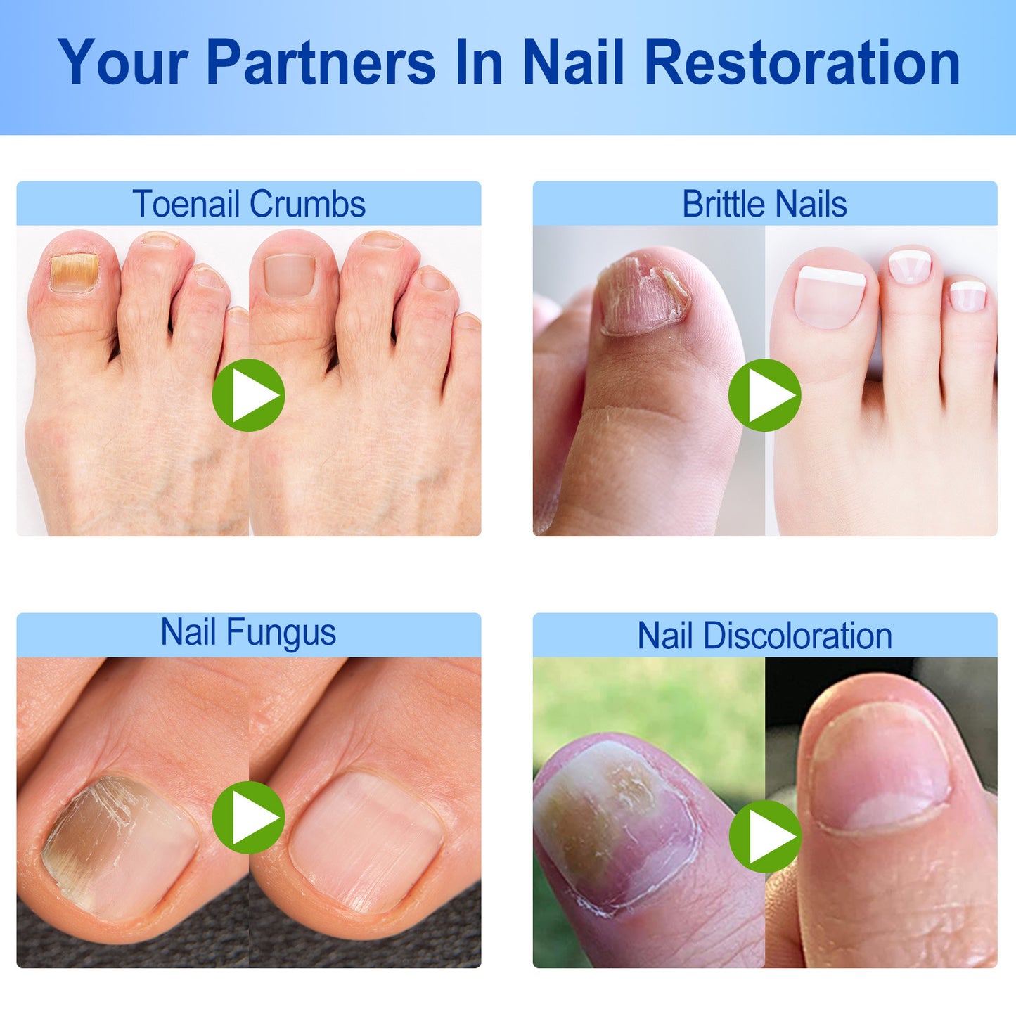 FungalFix™ - Fungal Nail Renewal Patches