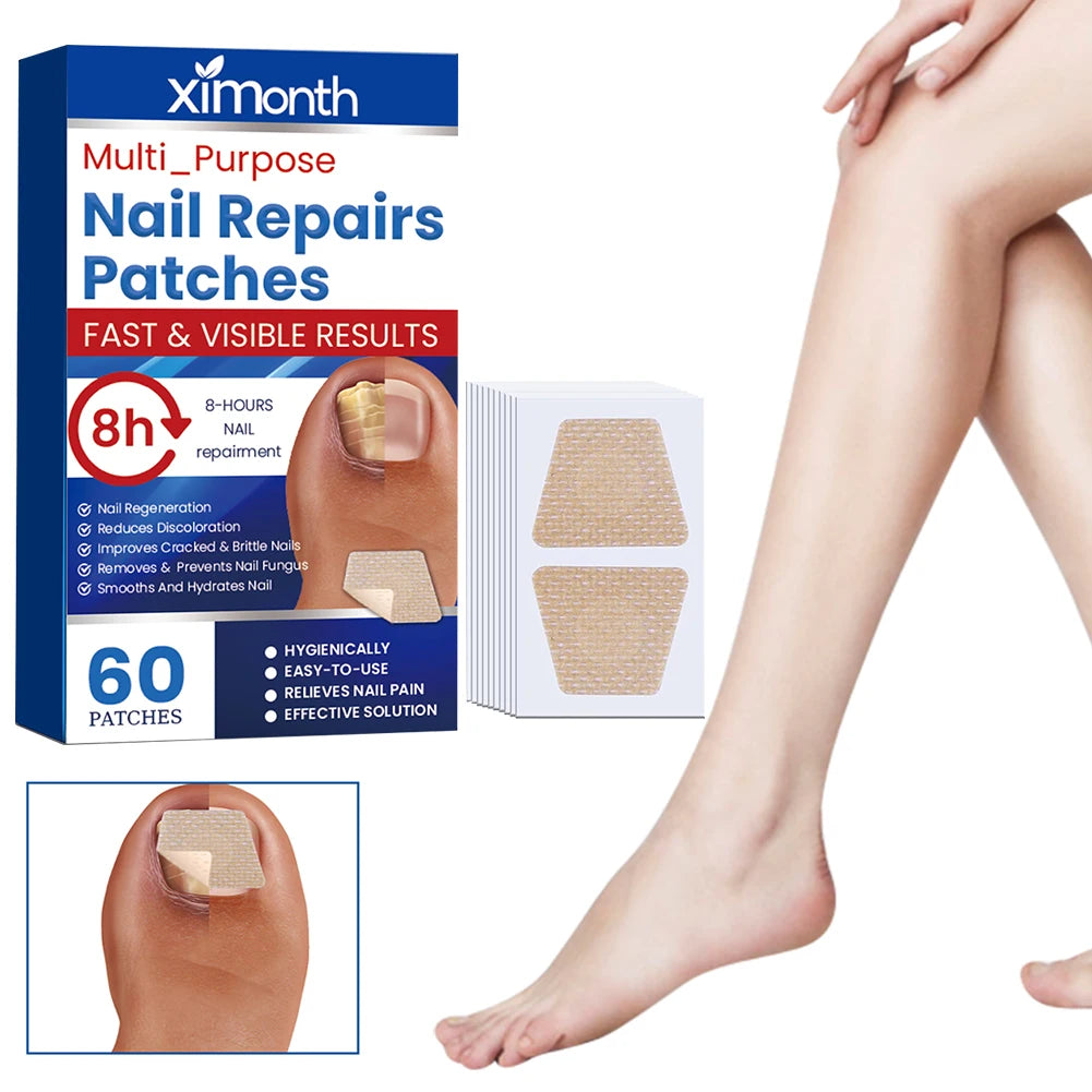 FungalFix™ - Fungal Nail Renewal Patches