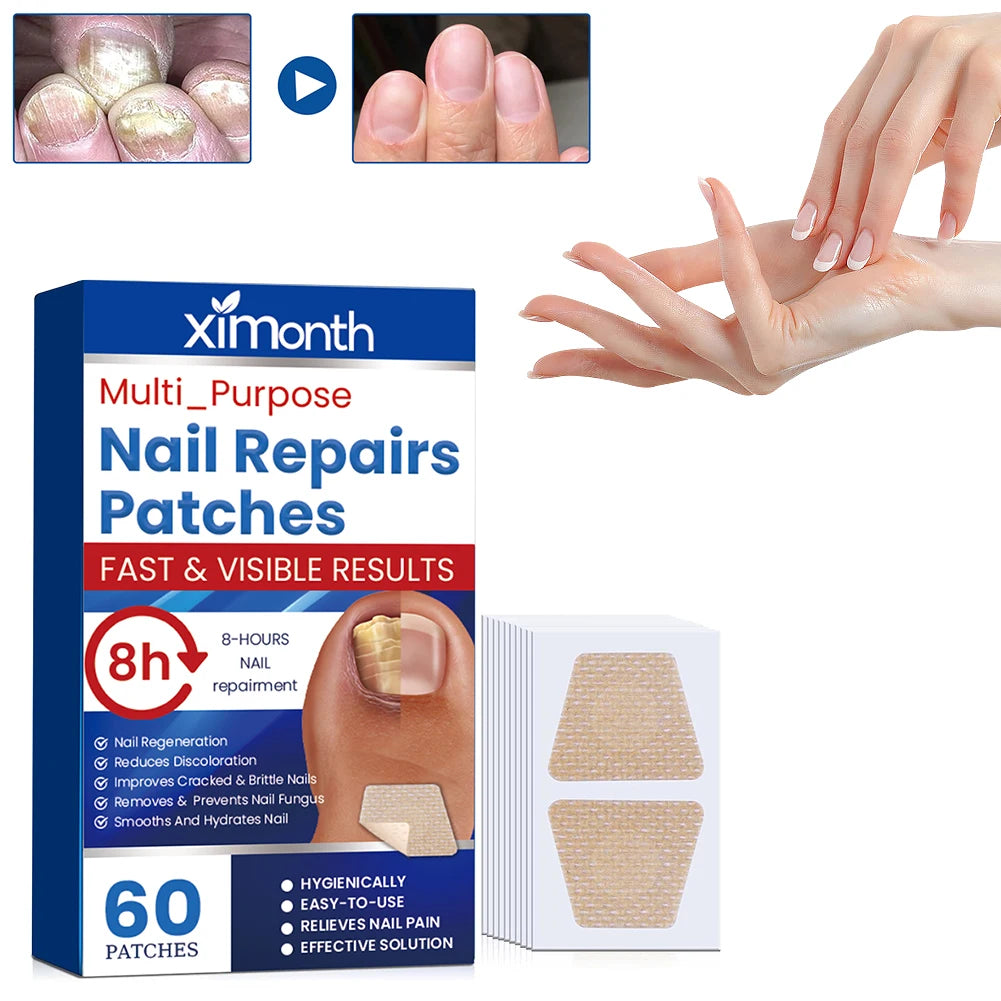 FungalFix™ - Fungal Nail Renewal Patches