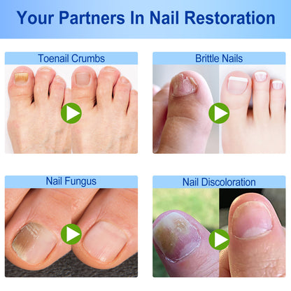 FungalFix™ - Fungal Nail Renewal Patches